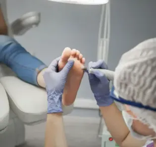 Tratamento de pés diabéticos em Joinville, Santa Catarina